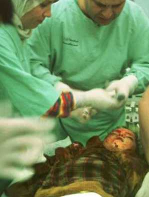 Médicos examinando el cadáver de Somaeah Hassan, una niña de seis  años asesinada durante un ataque israel� a un campo de refugiados